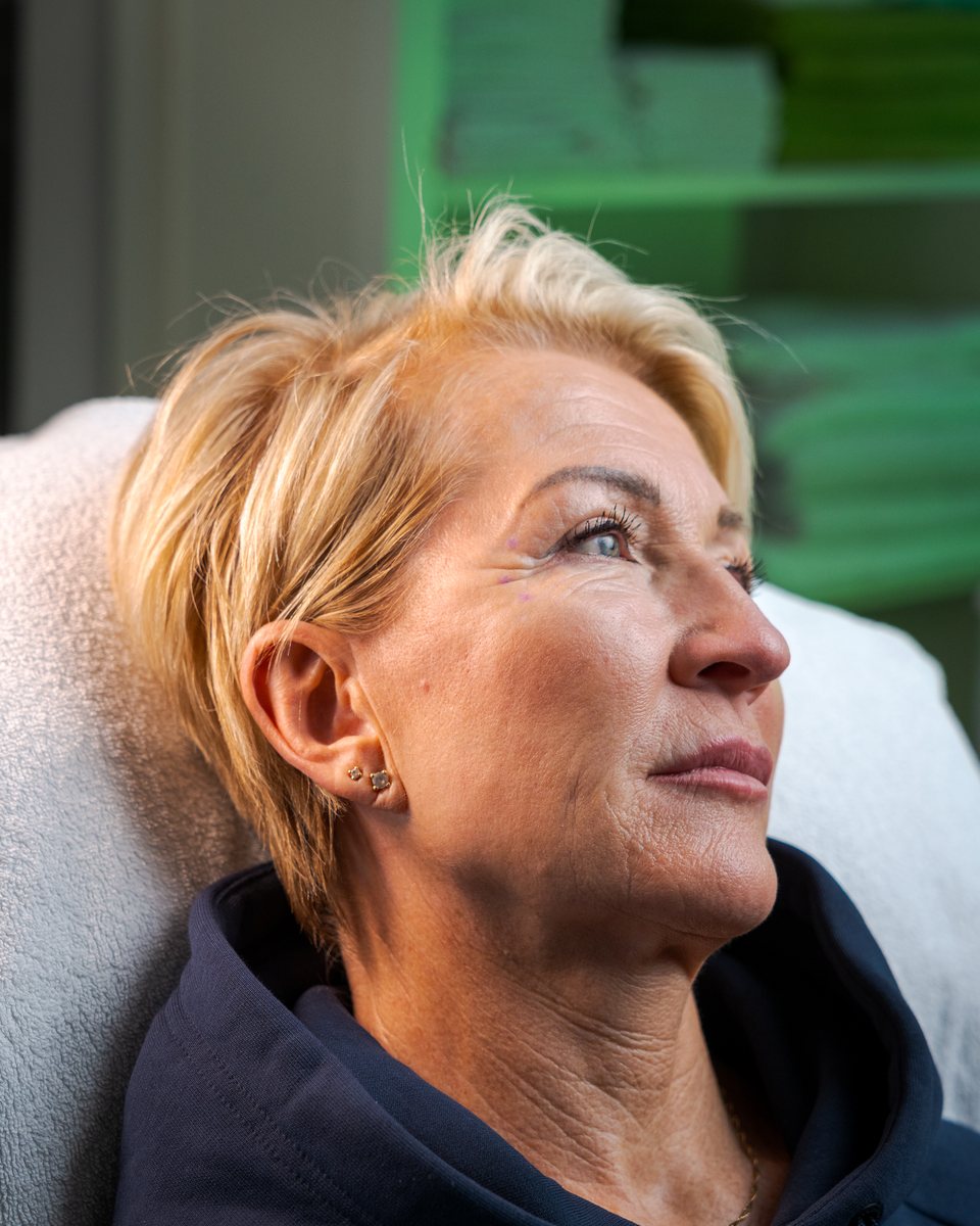 Kund i behandlingsstolen med små markeringar inför behandlingen